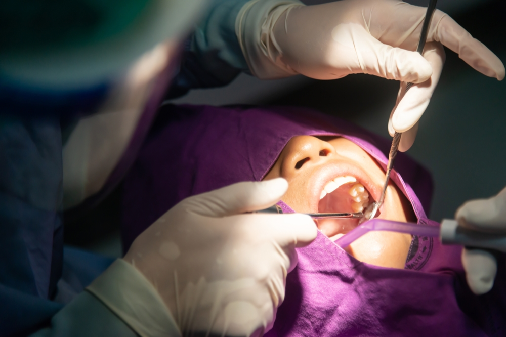 debunking myths about removing wisdom teeth